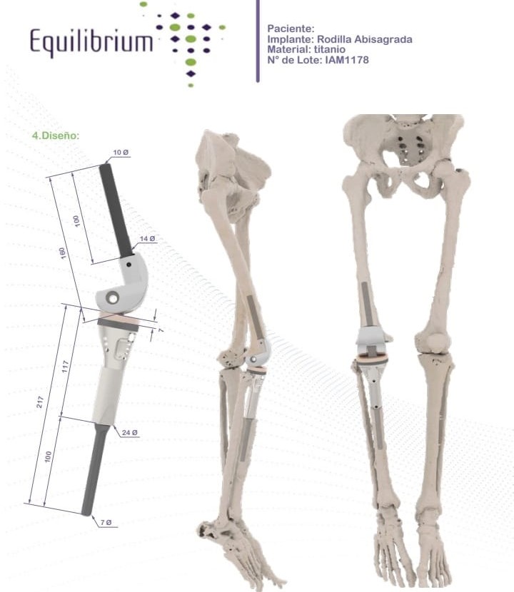 Impresión 3D de implantes médicos